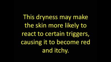 Eczema Causes 8 1680594453 maxresdefault