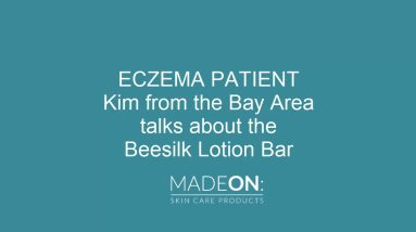 Kim's eczema gets relief from using the Beesilk lotion bar 20 1680596122 maxresdefault