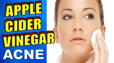 How To Use Apple Cider Vinegar For Acne, Face Toner & Eczema Treatment 4 1680606494 maxresdefault