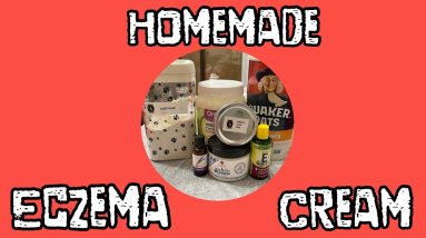 Homemade Eczema Cream 18 1680607496 maxresdefault