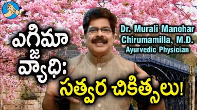 ఎగ్జిమా చర్మవ్యాధికి తిరుగులేని ఆయుర్వేద సులభ చికిత్సలు. Remedies for Eczema by Dr. Murali Manohar 16 1680609528 maxresdefault