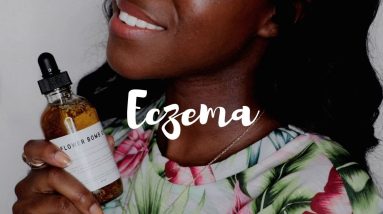 How to Treat Eczema (products + tips) | Lakisha Adams 14 1680609753 maxresdefault