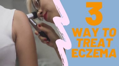 What's Eczema? How to Treat It? Please Watch This Video 10 1680610311 maxresdefault