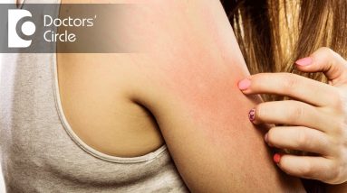 5 Top Causes of Itchy skin? - Dr. Urmila Nischal 6 1680611005 maxresdefault