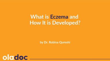 How to Treat Eczema In Urdu Hindi | Eczema Kya Hai | Kharish Ka Ilaj | How Does Eczema Develop 18 1680613885 maxresdefault