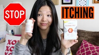 TREATING DRY & ITCHY ECZEMA (ft. Loma Lux) | now&jenn 8 1680616939 hqdefault