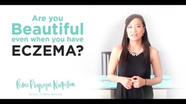 Are you beautiful even when you have eczema? 6 1680617068 hqdefault