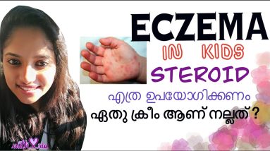 Eczema skin care | Moisturizers for kids | How to use steroid for eczema | Malayalam 20 1680626116 maxresdefault