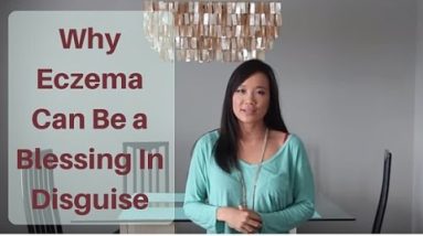 Why Eczema can be a Blessing in Disguise 18 1680626423 hqdefault