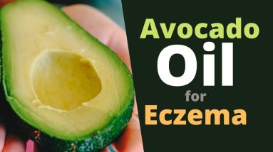 Avocado Oil for Eczema - Why it Works? 16 1680626523 maxresdefault