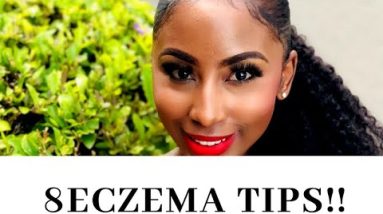 8 ECZEMA AND DRY SKIN TIPS | SKINCARE | 2019 6 1680630179 hqdefault