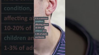 5 facts about eczema 2 1680630474 maxresdefault
