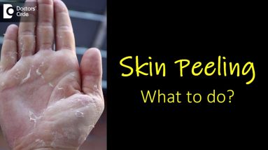 What causes skin peeling from fingers and feet? How to manage? - Dr. Rasya Dixit 6 1680634424 maxresdefault