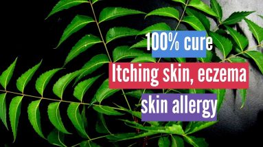Itching skin, Eczema, skin allergy Best Home Remedy - Neem Oil || Problem solved 16 1680638763 maxresdefault