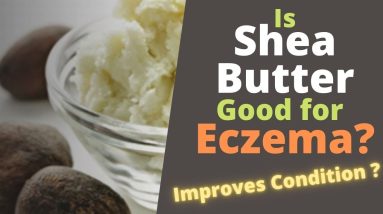 Is Shea Butter Good for Eczema? 14 1680638988 maxresdefault