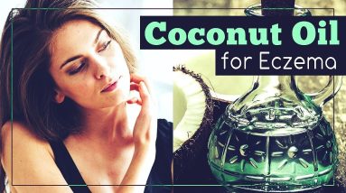 Coconut Oil for Eczema: How to Use It? 6 1680641788 maxresdefault