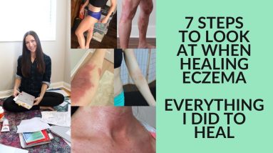 Healing eczema - sharing everything I did to heal 8 1680646443 maxresdefault