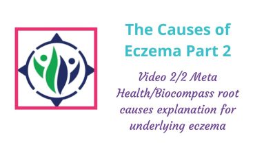What causes eczema Part II 6 1680646878 maxresdefault