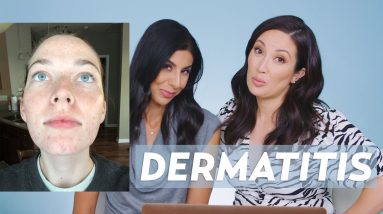 Perioral Dermatitis and Acne Skincare Routine for Jessie! 16 1680655645 maxresdefault