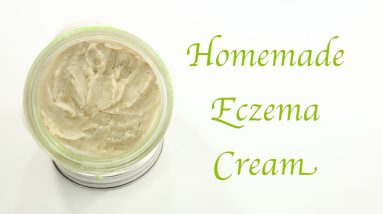 Homemade Eczema Cream 10 1680656644 maxresdefault