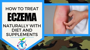 ECZEMA - How To Treat It Naturally With Diet & Supplements 8 1680674123 maxresdefault