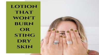 Use this cream for dry, flaky, and eczema skin 18 1680687126 maxresdefault