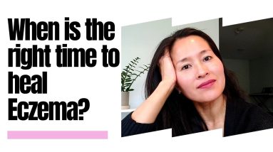 When is the right time to heal your eczema? 20 1680692197 maxresdefault