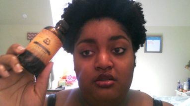 Dealing With Dandruff Caused By Eczema 18 1680692479 maxresdefault