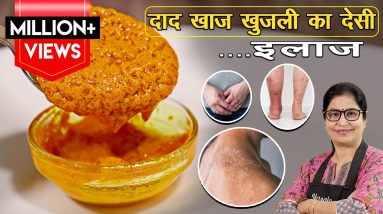 Eczema Home Made Remedy | घरेलू नुस्खे से दूर होगी खुजली और सूजन, बचेंगे पैसे,कभी नही होगा इंफेक्शन 12 1680699510 maxresdefault