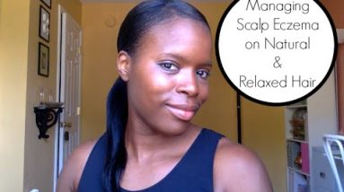Managing Scalp Eczema on Natural & Relaxed Hair 16 1680703909 hqdefault