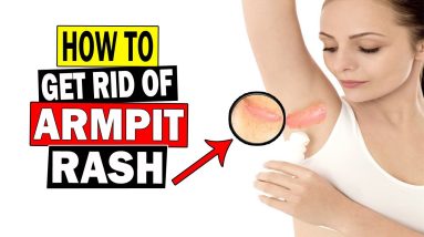 How To Get Rid Of Armpit Rash Naturally At Home || Home Remedies For Armpit Rash Treatment 2 1680713517 maxresdefault