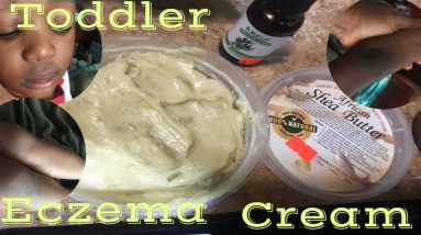 Toddle DIY Eczema Cream! 16 1680714532 maxresdefault