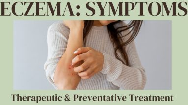 ECZEMA: Symptoms, Therapeutic and Preventative Treatment 14 1680715105 maxresdefault