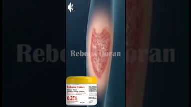Cream Psoriasis Herbal Antibacterial Anti-itch Relief Dermatitis Eczema Treatment Urticaria Peeling 12 1680721272 maxresdefault