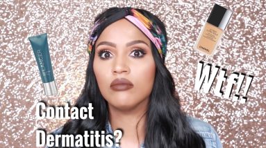 What Caused My Contact Dermatitis | MakeupShayla 6 1680722591 maxresdefault