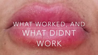 Cure a LIP Allergy! Big swollen, cracked & painful lips!! What works, what doesn't 20 1680725470 maxresdefault