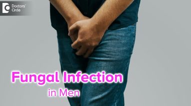 Fungal infection in Men. Causes & Treatment | Yeast Infection in Men- Dr. Nischal K|Doctors' Circle 6 1680729555 maxresdefault