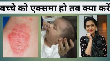 बच्चे को एलर्जी हो जाये तोह क्या करें । Baby eczema causes symptoms and treatments 4 1680734956 hqdefault