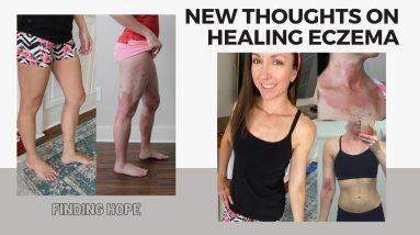 Is good health a promise from God? | Eczema healing 14 1680737989 maxresdefault