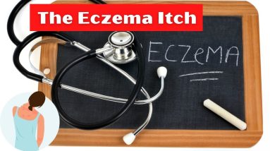 The Eczema Itch | Dermatology 10 1680738669 maxresdefault