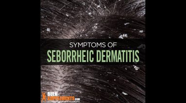 seborrheic dermatitis treatment - what is seborrheic dermatitis - what causes seborrheic dermatitis 8 1680738976 maxresdefault