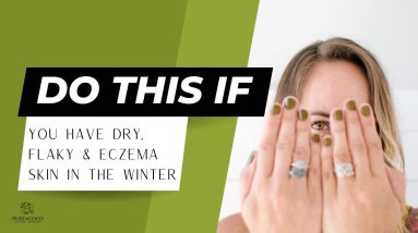 😍 Do THIS for dry, flaky, and Eczema Skin in 2023 - From someone who has dry and eczema skin 16 1680742691 maxresdefault