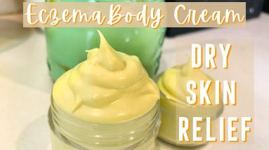 How to Make Homemade Eczema Cream | DIY Natural Itch Relief for Dry Skin 18 1680752895 maxresdefault