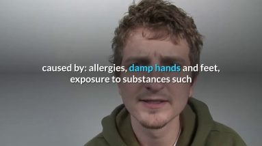 What Are the 7 Different Types of Eczema? 12 1680754248 maxresdefault