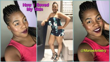 HOW I SAVED MY SKIN (Dry Skin & Eczema) 4 1680756591 maxresdefault