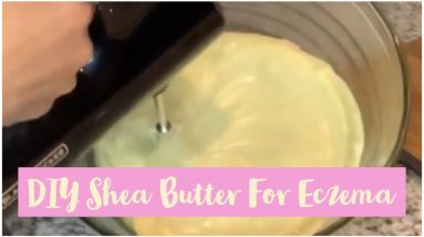 DIY Whipped Shea Butter For Eczema (Seborrheic Dermatitis) | Only 2 Ingredients | NATURAL HAIR 14 1680764693 maxresdefault