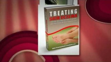 Babies With Eczema -- What to Do 2 1680768059 hqdefault