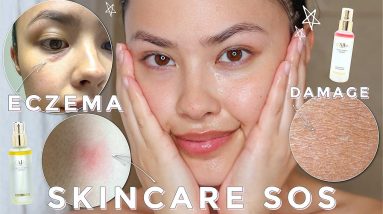 My Current and Best Skincare Tips I'm Currently Doing | *eczema, bites, and dry, itchy skin* 20 1680768415 maxresdefault