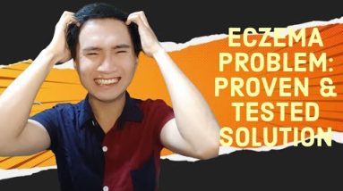 ECZEMA PROBLEM: MEANING AND CAUSES(ganto pala para maiwasan)😱🤔 #viral #trending #diy #video 18 1680769150 hqdefault