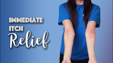 Immediate Eczema Itch Relief | Michelle Mills 10 1680770885 maxresdefault
